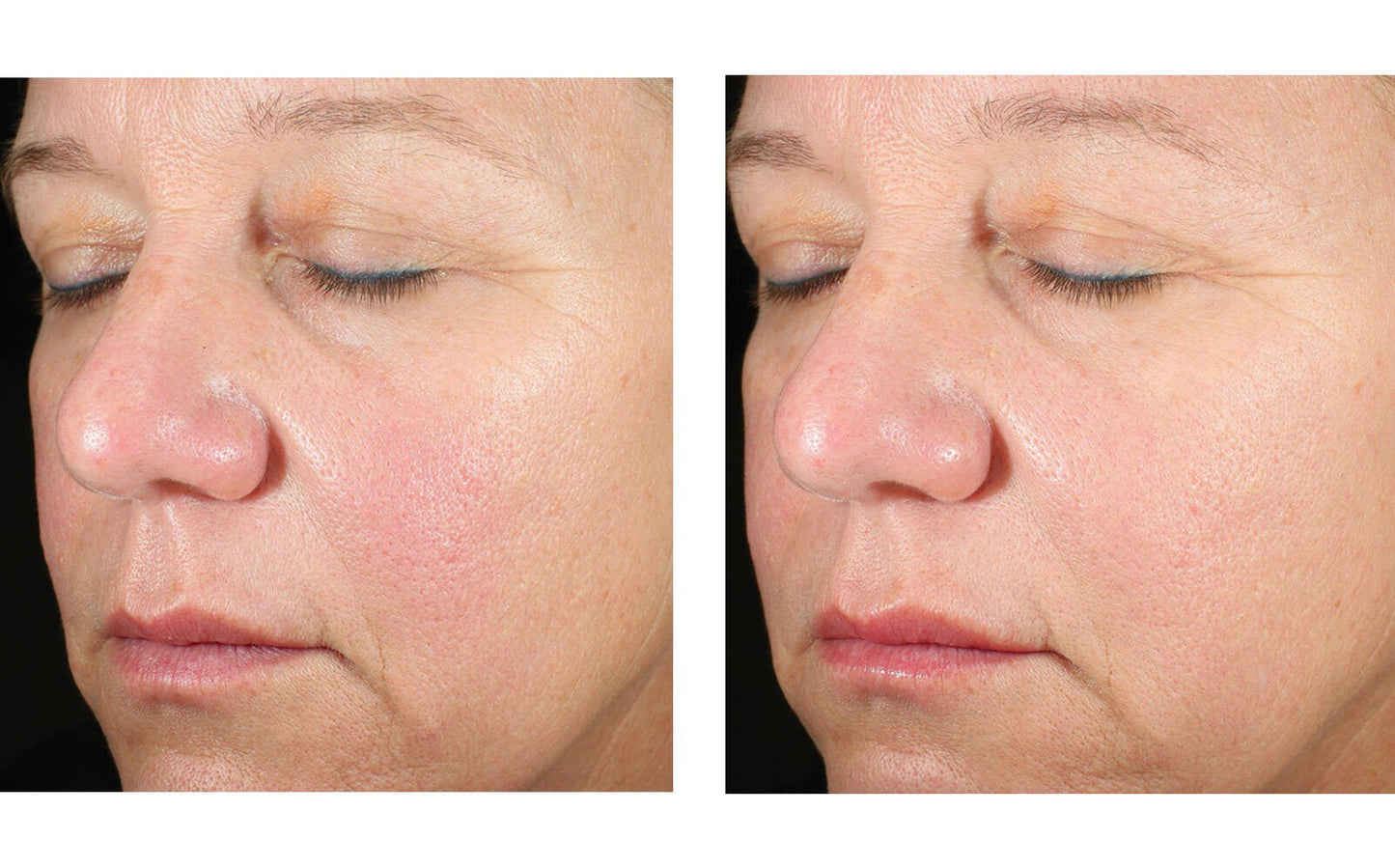 Alto Advanced Defense & Repair Serum 30 ml